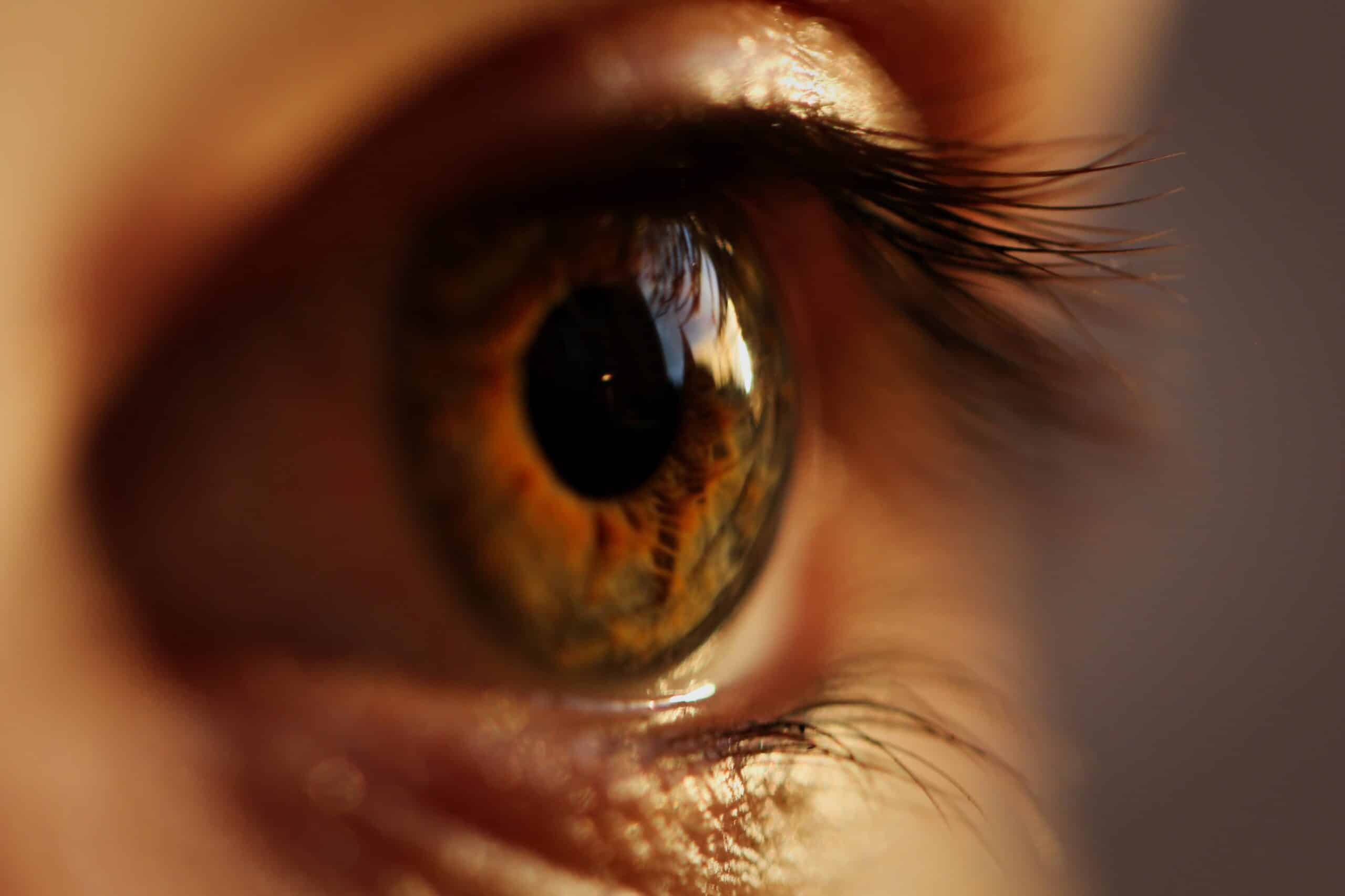Pink-eye-symptoms-in adults