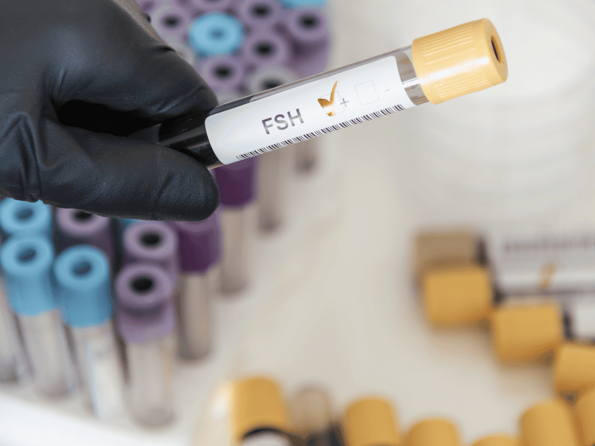 female fertility tests